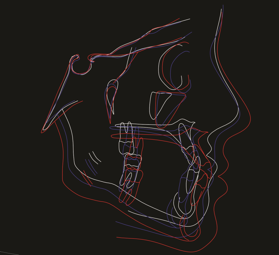 screenshot of AudaxCeph