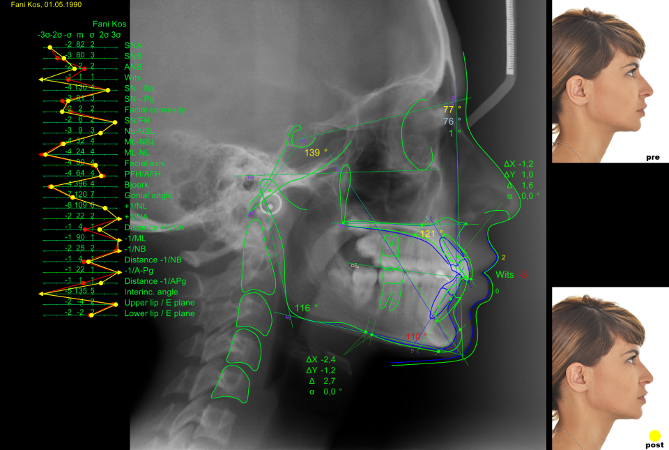 screenshot of AudaxCeph