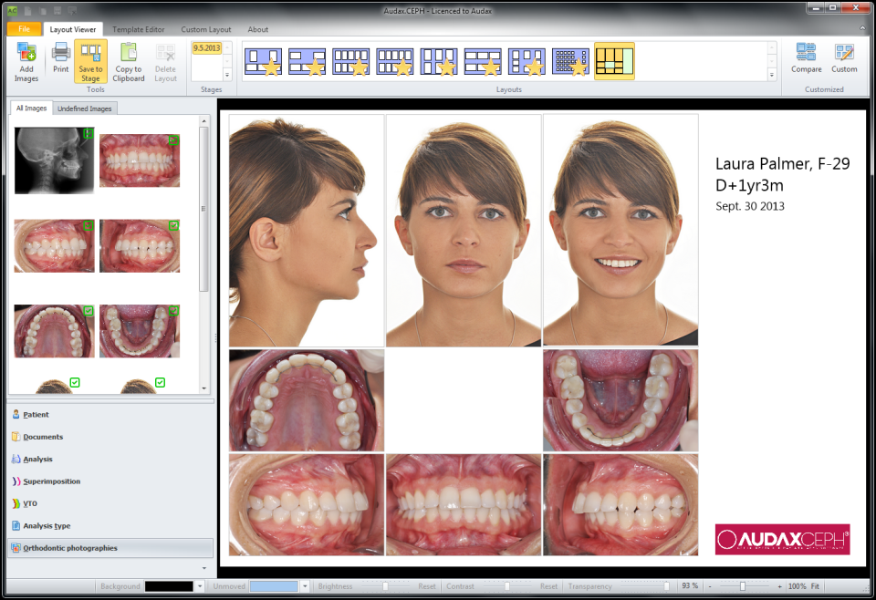 screenshot of AudaxCeph