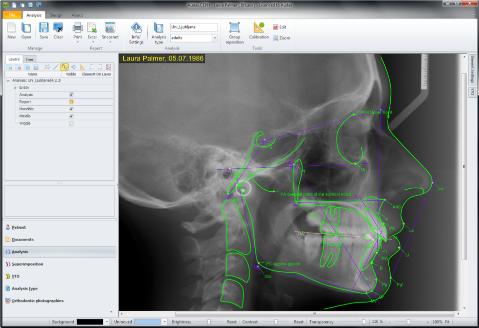 screenshot of AudaxCeph