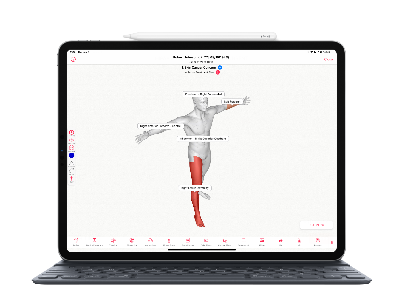 screenshot of EZDERM