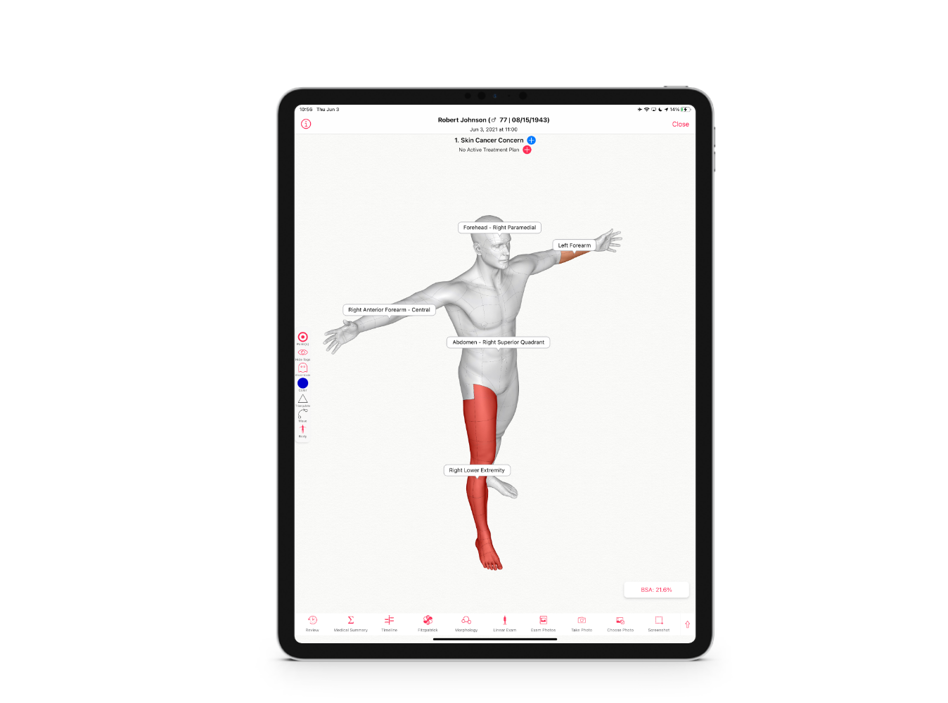 screenshot of EZDERM