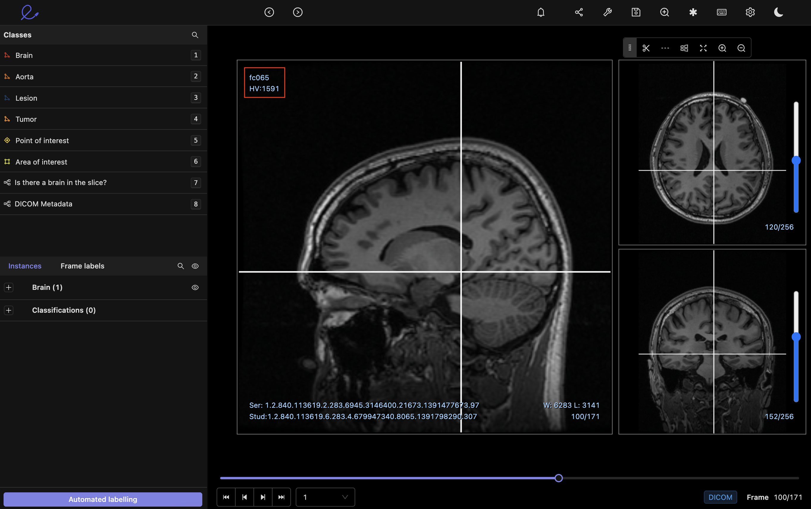 screenshot of Encord