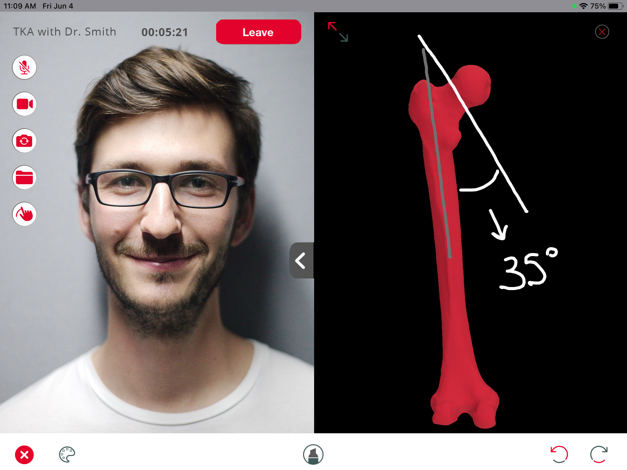 screenshot of Enhatch