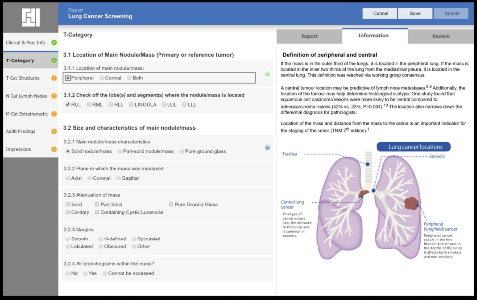 screenshot of LogicNets