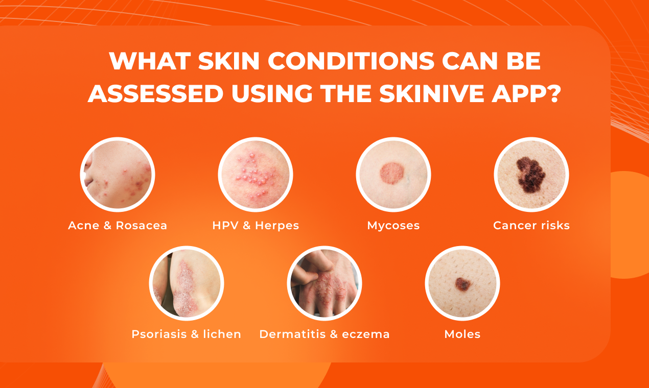 screenshot of Skinive