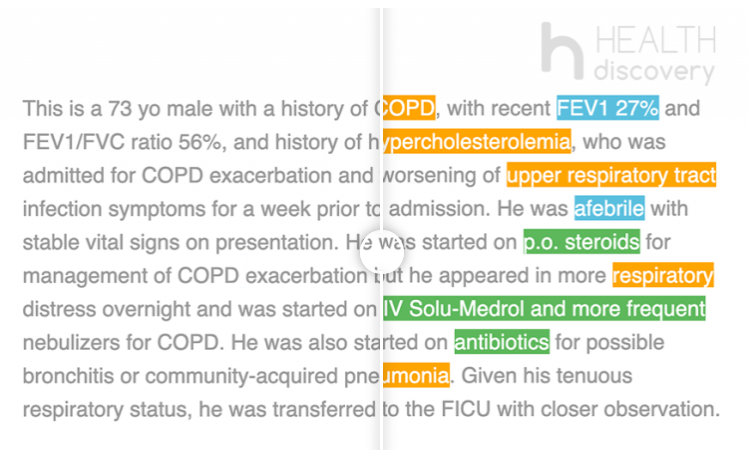 screenshot of Speech2Structure