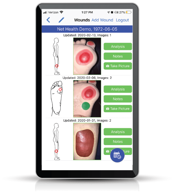 screenshot of WoundExpert