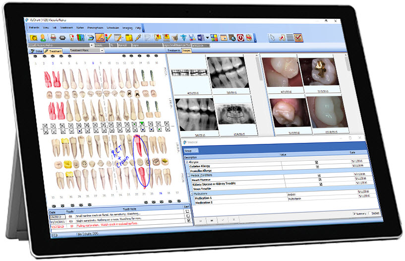 screenshot of XLDent