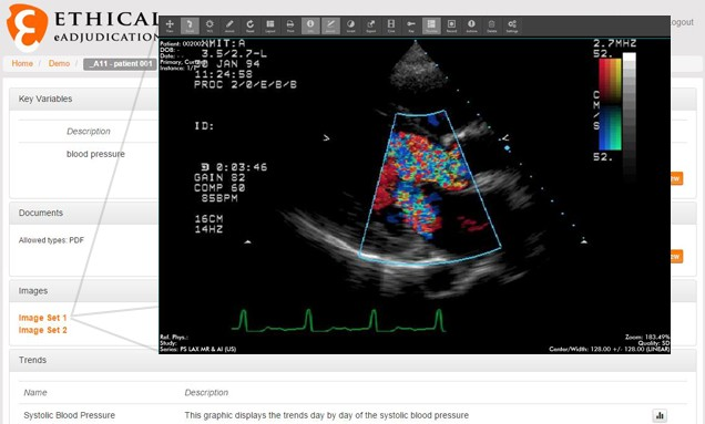 screenshot of eAdjudication